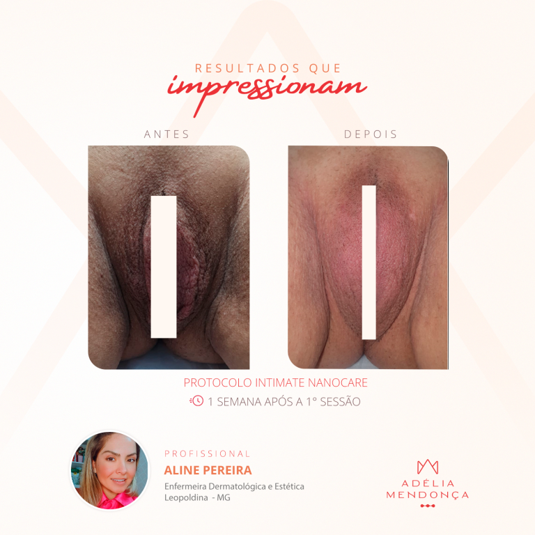 Resultado¹_1